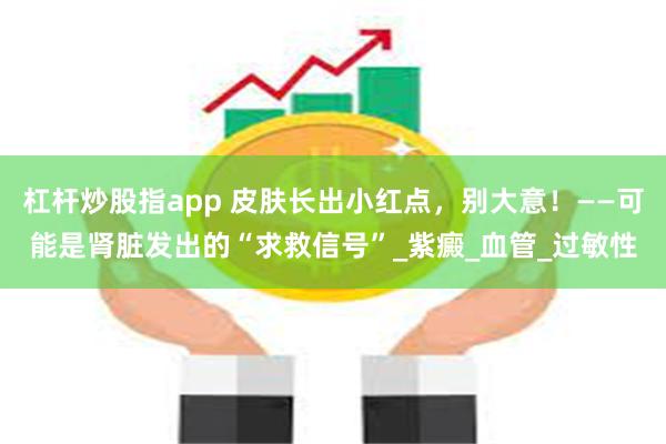 杠杆炒股指app 皮肤长出小红点，别大意！——可能是肾脏发出的“求救信号”_紫癜_血管_过敏性